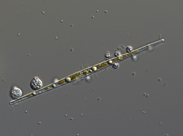 ツボカビに狙い撃ちされる植物プランクトン -集中的多重感染- 先端理工学部 三木健教授らの論文が“Aquatic Microbial Ecology”に掲載【研究部・先端理工学部】~植物プランクトンへのツボカビ寄生における集中的感染パターンの解明~